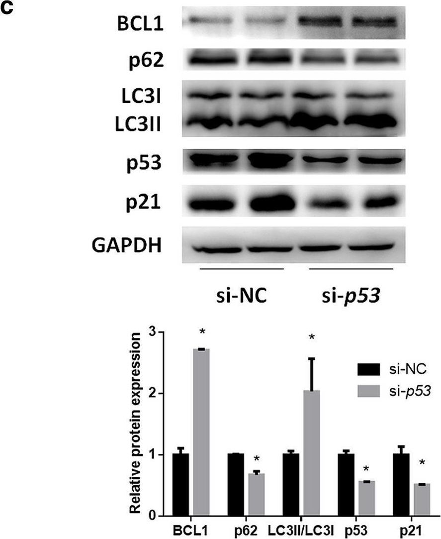 Fig.2.C showing Western Blotting from the publication: Silencing of functional p53 attenuates NAFLD by promoting HMGB1-related autophagy induction.