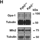 Fig.5.H showing Western Blotting from the publication: Pyk2 Regulates MAMs and Mitochondrial Dynamics in Hippocampal Neurons.