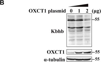 Fig.1.B showing Western Blotting in a Mus musculus (House mouse) sample from the publication: β-hydroxybutyrate serves as a regulator in ketone body metabolism through lysine β-hydroxybutyrylation.