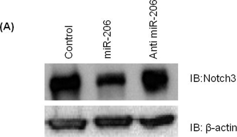 Fig.6.A showing Western Blotting in a Homo sapiens (Human) sample from the publication: Mir-206 regulates pulmonary artery smooth muscle cell proliferation and differentiation.