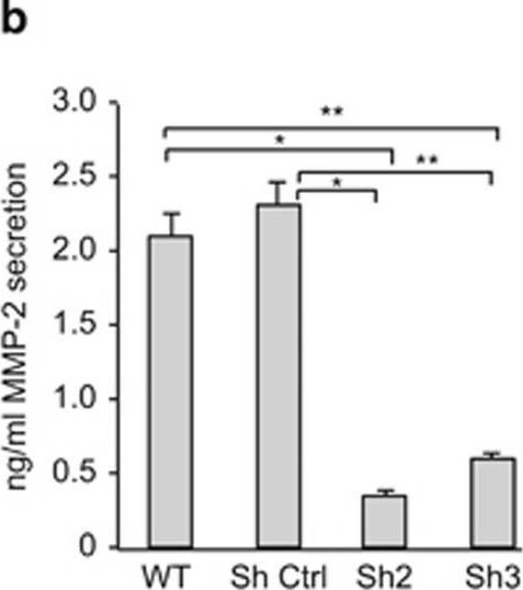 Fig.5.B showing Enzyme-linked immunosorbent assay from the publication: TLX activates MMP-2, promotes self-renewal of tumor spheres in neuroblastoma and correlates with poor patient survival.