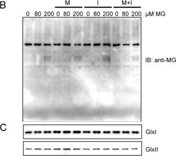 Fig.3.B showing Western Blotting from the publication: Biochemical Regulation of the Glyoxalase System in Response to Insulin Signaling.