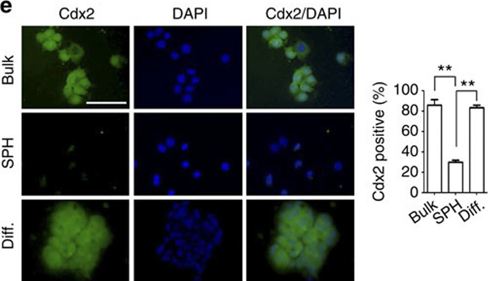 Fig.1.E showing Immunocytochemistry-immunofluorescence in a Homo sapiens (Human) sample from the publication: Suspension survival mediated by PP2A-STAT3-Col XVII determines tumour initiation and metastasis in cancer stem cells.