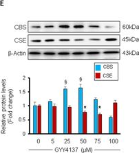 Fig.1.E showing Western Blotting in a Mus musculus (House mouse) sample from the publication: H2S and homocysteine control a novel feedback regulation of cystathionine beta synthase and cystathionine gamma lyase in cardiomyocytes.