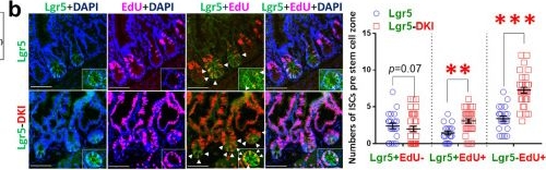 Fig.3.B showing Immunohistochemistry-immunofluorescence from the publication: Tetrameric STAT5 regulates the formation of immune niche cells to protect stem cell regenerative repair against mucosal inflammation.