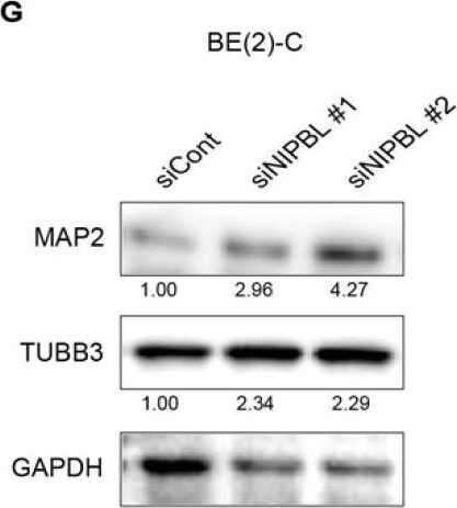Fig.5.G showing Western Blotting from the publication: Cohesin Loading Factor NIPBL Is Essential for MYCN Expression and MYCN-Driven Oncogenic Transcription in Neuroblastoma.