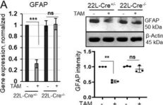 GFAP (D1F4Q) XP® Rabbit mAb | Cell Signaling Technology