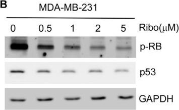 Fig.2.B showing Western Blotting in a Homo sapiens (Human) sample from the publication: CDK4/6 Inhibitors Suppress RB-Null Triple-Negative Breast Cancer by Inhibiting Mutant P53 Expression via RBM38 RNA-Binding Protein.