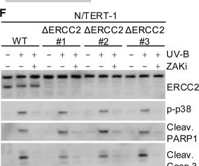 Fig.6.F showing Western Blotting from the publication: The ribotoxic stress response drives acute inflammation, cell death, and epidermal thickening in UV-irradiated skin in&nbsp;vivo.