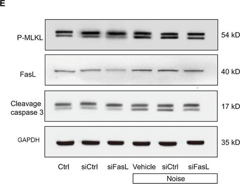 Fig.9.E showing Western Blotting in a Mus musculus (House mouse) sample from the publication: NFAT3-FasL axis synchronously regulates apoptosis and necroptosis in murine cochlear outer hair cells after noise trauma.