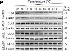 Fig.5.P showing Western Blotting in a Homo sapiens (Human) sample from the publication: S100a9 lactylation triggers neutrophil trafficking and cardiac inflammation in myocardial ischemia/reperfusion injury.