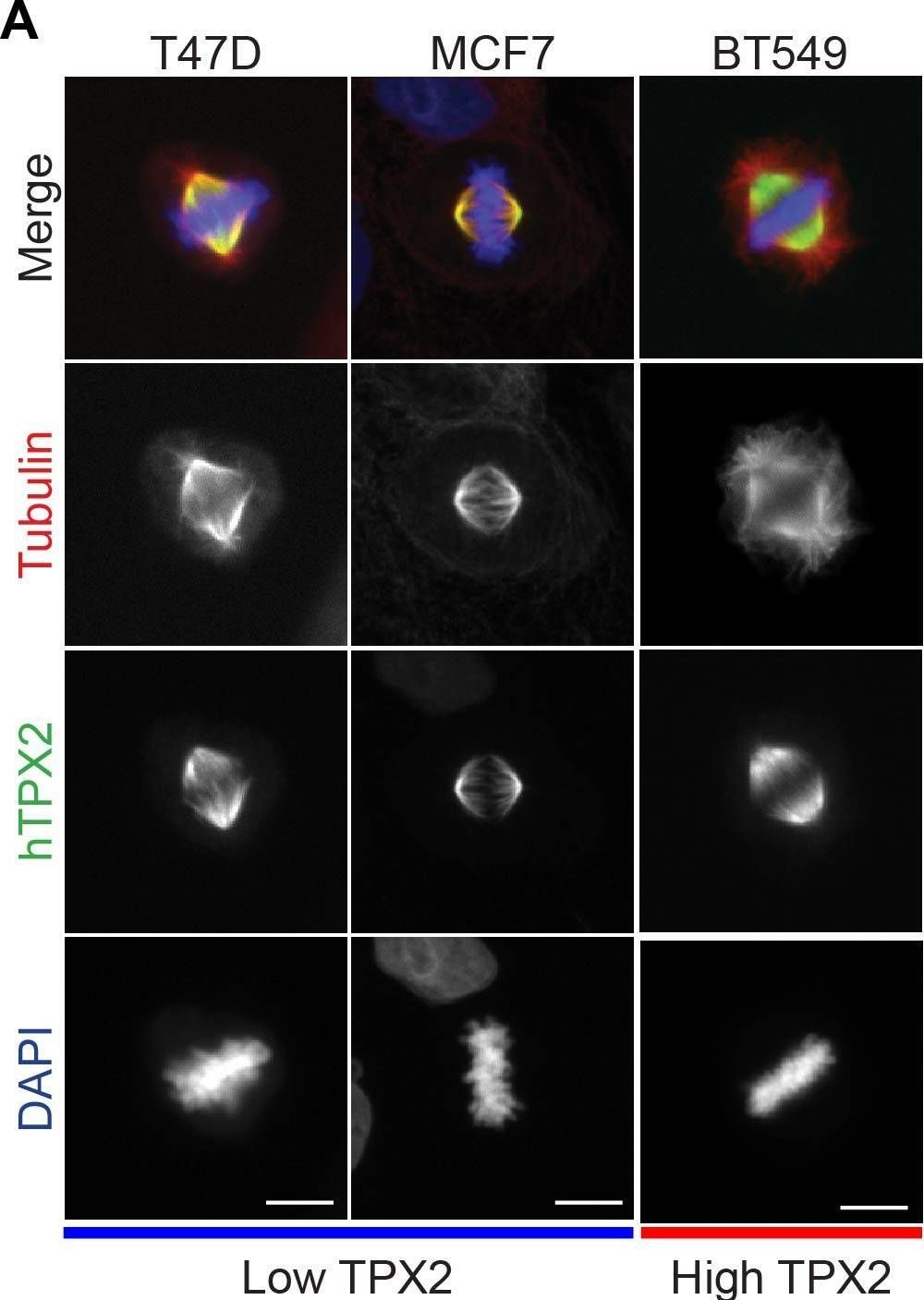 Fig.1.A showing Immunocytochemistry-immunofluorescence in a Homo sapiens (Human) sample from the publication: Changes in spindle morphology driven by TPX2 overexpression in MYC-driven breast cancer cells.