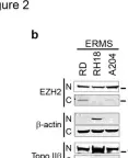 Fig.2.B showing Western Blotting from the publication: Pharmacological inhibition of EZH2 as a promising differentiation therapy in embryonal RMS.