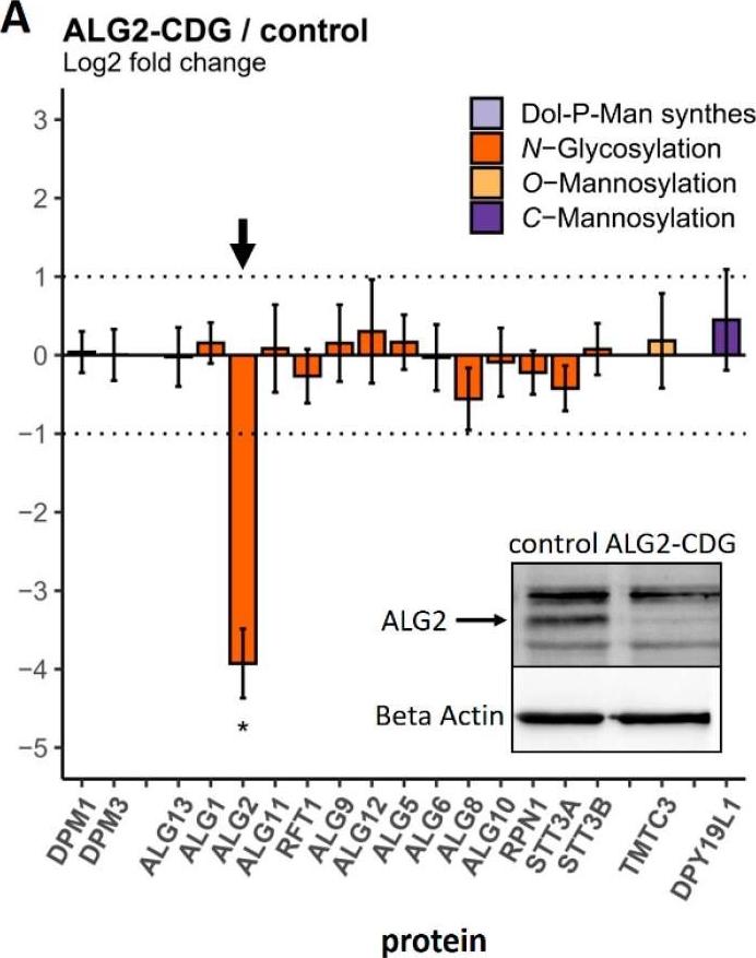 Fig.5.A showing Western Blotting in a Homo sapiens (Human) sample from the publication: Targeted Proteomics Reveals Quantitative Differences in Low-Abundance Glycosyltransferases of Patients with Congenital Disorders of Glycosylation.
