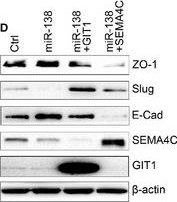 Fig.7.D showing Western Blotting in a Homo sapiens (Human) sample from the publication: MiR-138 inhibits cell proliferation and reverses epithelial-mesenchymal transition in non-small cell lung cancer cells by targeting GIT1 and SEMA4C.