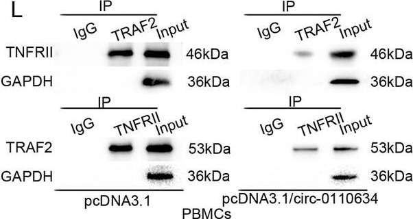 Fig.4.L showing Western Blotting from the publication: Triptolide attenuates inhibition of ankylosing spondylitis-derived mesenchymal stem cells on the osteoclastogenesis through modulating exosomal transfer of circ-0110634.
