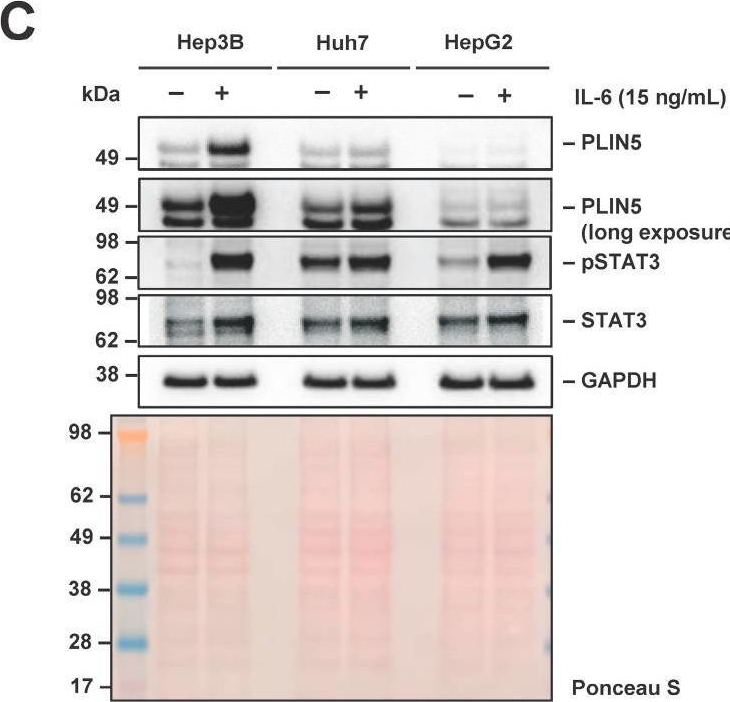 Fig.2.C showing Western Blotting in a Homo sapiens (Human) sample from the publication: Lipid-Independent Regulation of PLIN5 via IL-6 through the JAK/STAT3 Axis in Hep3B Cells.