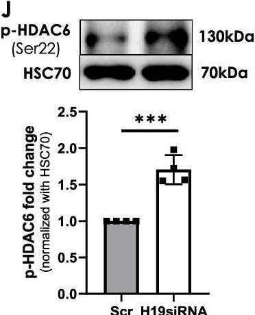 Fig.2.L showing Western Blotting in a Mus musculus (House mouse) sample from the publication: H19 inhibition increases HDAC6 and regulates IRS1 levels and insulin signaling in the skeletal muscle during diabetes.