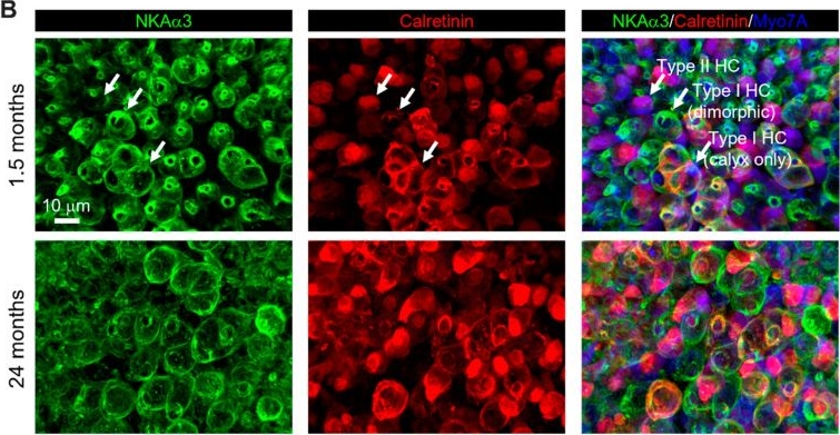 Fig.2.B showing Immunohistochemistry-immunofluorescence from the publication: Functional, Morphological and Molecular Changes Reveal the Mechanisms Associated with Age-Related Vestibular Loss.