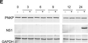 Fig.1.E showing Western Blotting in a Homo sapiens (Human) sample from the publication: Zika Virus Induces Mitotic Catastrophe in Human Neural Progenitors by Triggering Unscheduled Mitotic Entry in the Presence of DNA Damage While Functionally Depleting Nuclear PNKP.