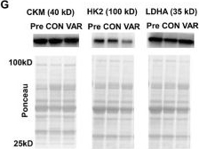 Fig.2.G showing Western Blotting in a Rattus norvegicus (Rat) sample from the publication: Frequent Manipulation of Resistance Training Variables Promotes Myofibrillar Spacing Changes in Resistance-Trained Individuals.