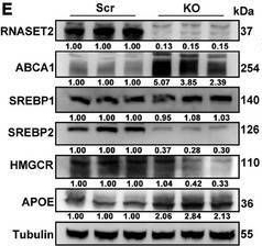 Fig.2.E showing Western Blotting in a Homo sapiens (Human) sample from the publication: RNASET2 Deficiency Induces Hepatocellular Carcinoma Metastasis through Cholesterol-Triggered MET Activation.