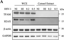 Fig.4.A showing Western Blotting in a Homo sapiens (Human) sample from the publication: Herpes Simplex Virus Type 1 Infection Disturbs the Mitochondrial Network, Leading to Type I Interferon Production through the RNA Polymerase III/RIG-I Pathway.