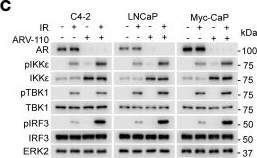 Fig.5.C showing Western Blotting from the publication: Reversing enhancer RNA-mediated IKBKE gene repression enables synthetic anticancer immunity in prostate cancer models.