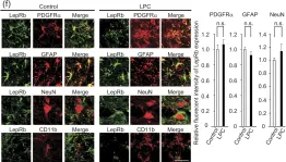 Fig.2.F showing Immunohistochemistry-immunofluorescence in a Mus musculus (House mouse) sample from the publication: Leptin sustains spontaneous remyelination in the adult central nervous system.