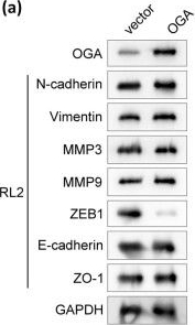 Fig.5.A showing Western Blotting from the publication: Artesunate inhibits hepatocellular carcinoma cell migration and invasion through OGA-mediated O-GlcNAcylation of ZEB1.