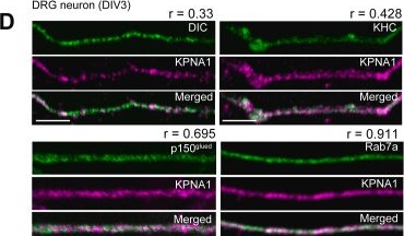 Fig.2.D showing Immunohistochemistry-immunofluorescence from the publication: Direct observation of importin α family member KPNA1 in axonal transport with or without a schizophrenia-related mutation.
