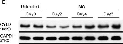 Fig.1.D showing Western Blotting from the publication: CYLD Limits Neutrophil-Driven Psoriatic Inflammation.