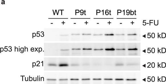 Fig.4.A showing Western Blotting from the publication: Rewiring glucose metabolism improves 5-FU efficacy in p53-deficient/KRASG12D glycolytic colorectal tumors.