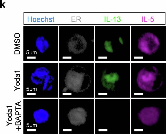 Fig.3.K showing Immunocytochemistry-immunofluorescence from the publication: Piezo1-mediated mechanotransduction regulates the translational activity, function and lung pathogenicity of group 2 innate lymphoid cells.
