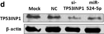 Fig.3.D showing Western Blotting in a Homo sapiens (Human) sample from the publication: miR-524-5p of the primate-specific C19MC miRNA cluster targets TP53IPN1- and EMT-associated genes to regulate cellular reprogramming.
