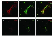 Fig.3.J,K,L,M,N,O,P showing Immunohistochemistry-immunofluorescence in a Mus musculus (House mouse) sample from the publication: NG2 proteoglycan-dependent recruitment of tumor macrophages promotes pericyte-endothelial cell interactions required for brain tumor vascularization.