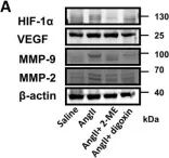 Fig.5.A showing Western Blotting from the publication: Inhibition of hypoxia inducible factor-1α attenuates abdominal aortic aneurysm progression through the down-regulation of matrix metalloproteinases.