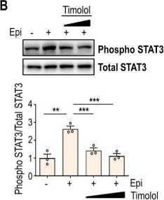 Fig.3.B showing Western Blotting from the publication: Epinephrine as a potential driver of oral lichen planus pathogenesis.
