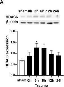 Fig.3.A showing Western Blotting in a Rattus norvegicus (Rat) sample from the publication: Endoplasmic reticulum stress caused by traumatic injury promotes cardiomyocyte apoptosis through acetylation modification of GRP78.