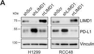 Fig.1.A showing Western Blotting from the publication: Clonal LIMD1 loss drives PD-L1 immune evasion via ARIH1-dependent ubiquitination in lung cancer.