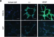 Fig.3.D showing Immunocytochemistry-immunofluorescence in a Homo sapiens (Human) sample from the publication: Vascular endothelial growth factor receptor 2 (VEGFR-2) plays a key role in vasculogenic mimicry formation, neovascularization and tumor initiation by Glioma stem-like cells.