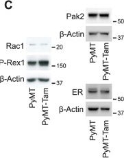 Fig.4.C showing Western Blotting in a Mus musculus (House mouse) sample from the publication: Endocrine therapy reprogramming of breast cancer facilitates metastatic escape via upregulation of P-Rex1/Rac1 signalling.