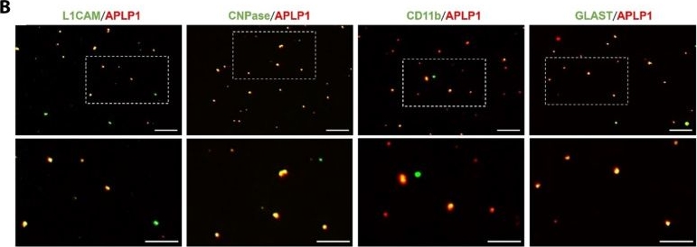 Fig.5.B showing Immunocytochemistry-immunofluorescence in a Homo sapiens (Human) sample from the publication: Blood-derived APLP1+ extracellular vesicles are potential biomarkers for the early diagnosis of brain diseases.