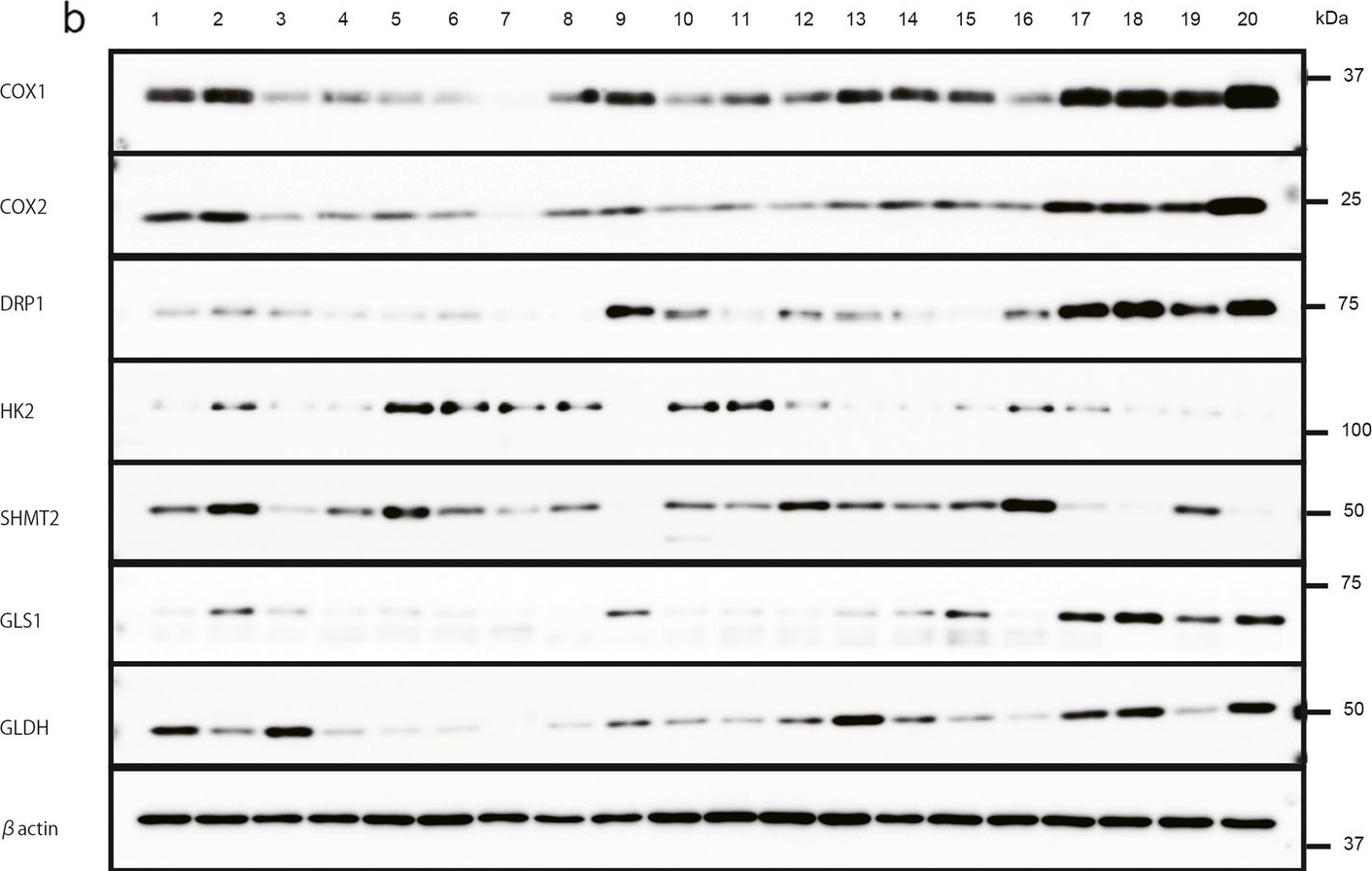 Fig.1.B showing Western Blotting from the publication: Glutaminolysis is associated with mitochondrial pathway activation and can be therapeutically targeted in glioblastoma.
