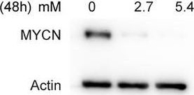 Fig.3.D showing Western Blotting in a Homo sapiens (Human) sample from the publication: Ceftriaxone exerts antitumor effects in MYCN-driven retinoblastoma and neuroblastoma by targeting DDX3X for translation repression.