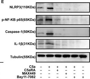 Fig.5.E showing Western Blotting from the publication: The novel B-cell epitope peptide vaccine, MAX449, exhibits significant anti-tumor efficacy and enhances the therapeutic effects of PD-1 antibodies on tumors by modulating the activity of PMN-MDSCs.