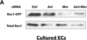 Fig.6.A showing Western Blotting from the publication: The role of endothelial MERTK during the inflammatory response in lungs.