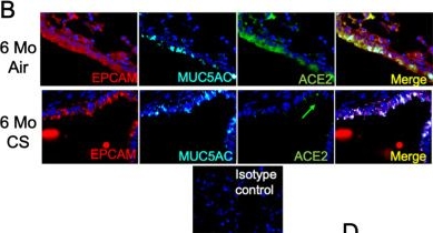 Fig.2.B showing Immunohistochemistry-immunofluorescence in a Mus musculus (House mouse) sample from the publication: Paradoxical effects of cigarette smoke and COPD on SARS-CoV-2 infection and disease.