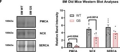 Fig.12.F showing Western Blotting from the publication: An Orai1 gain-of-function tubular aggregate myopathy mouse model phenocopies key features of the human disease.