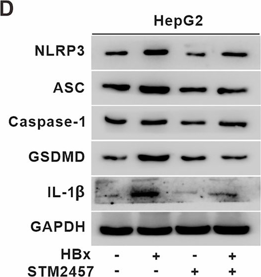 Fig.6.D showing Western Blotting from the publication: Hepatic steatosis and pyroptosis are induced by the hepatitis B virus X protein via B56α-METTL3 interaction-mediated m6A modification of the NLRP3 mRNA.